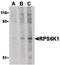 Ribosomal Protein S6 Kinase A1 antibody, LS-B1397, Lifespan Biosciences, Western Blot image 