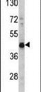 3-Hydroxyisobutyryl-CoA Hydrolase antibody, PA5-14336, Invitrogen Antibodies, Western Blot image 