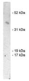 Siah E3 Ubiquitin Protein Ligase 1 antibody, orb198345, Biorbyt, Western Blot image 