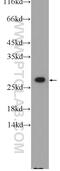 Calpain Small Subunit 1 antibody, 25057-1-AP, Proteintech Group, Western Blot image 