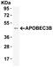 Apolipoprotein B MRNA Editing Enzyme Catalytic Subunit 3B antibody, A01088, Boster Biological Technology, Western Blot image 