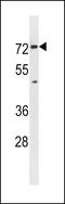 Solute Carrier Family 5 Member 8 antibody, LS-C157934, Lifespan Biosciences, Western Blot image 