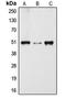 Dynactin Subunit 2 antibody, LS-C353266, Lifespan Biosciences, Western Blot image 