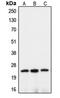 OSP-like protein antibody, MBS822291, MyBioSource, Western Blot image 