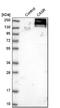 Calcium Sensing Receptor antibody, NBP1-84687, Novus Biologicals, Western Blot image 