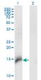 Chibby Family Member 1, Beta Catenin Antagonist antibody, MA5-21555, Invitrogen Antibodies, Western Blot image 