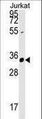 Zinc Finger FYVE-Type Containing 27 antibody, LS-C160788, Lifespan Biosciences, Western Blot image 