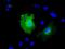 Kelch Repeat And BTB Domain Containing 7 antibody, NBP2-02742, Novus Biologicals, Immunofluorescence image 