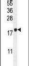 Pro-X-Gly Collagen Triple Helix Like Repeat Containing antibody, PA5-24138, Invitrogen Antibodies, Western Blot image 