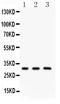 Peroxiredoxin 4 antibody, LS-C357571, Lifespan Biosciences, Western Blot image 