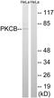 Protein Kinase C Beta antibody, LS-C118321, Lifespan Biosciences, Western Blot image 