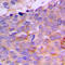 Cellular Retinoic Acid Binding Protein 2 antibody, LS-C352040, Lifespan Biosciences, Immunohistochemistry frozen image 