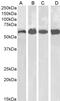 Catalase antibody, PA5-18531, Invitrogen Antibodies, Western Blot image 
