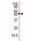 Calcium/Calmodulin Dependent Protein Kinase Kinase 1 antibody, F50752-0.4ML, NSJ Bioreagents, Western Blot image 