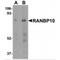 RAN Binding Protein 10 antibody, MBS151209, MyBioSource, Western Blot image 