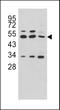 Carboxypeptidase A4 antibody, LS-C100517, Lifespan Biosciences, Western Blot image 