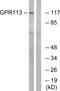 Adhesion G Protein-Coupled Receptor F3 antibody, PA5-39619, Invitrogen Antibodies, Western Blot image 