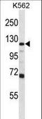 Glutamate Ionotropic Receptor AMPA Type Subunit 4 antibody, LS-C166670, Lifespan Biosciences, Western Blot image 