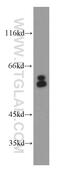ADP Ribosylation Factor GTPase Activating Protein 3 antibody, 15293-1-AP, Proteintech Group, Western Blot image 
