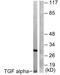 Transforming Growth Factor Alpha antibody, abx013207, Abbexa, Western Blot image 