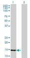 Ubiquitin-conjugating enzyme E2 B antibody, H00007320-M06, Novus Biologicals, Western Blot image 