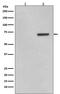 Activating Transcription Factor 2 antibody, P00916-3, Boster Biological Technology, Western Blot image 