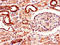 Adenosine A2b Receptor antibody, LS-C498282, Lifespan Biosciences, Immunohistochemistry paraffin image 