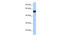 Cholinergic Receptor Nicotinic Gamma Subunit antibody, AVARP13024_P050, Aviva Systems Biology, Western Blot image 