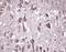 Ubiquitin C-Terminal Hydrolase L1 antibody, 38-1000, Invitrogen Antibodies, Immunohistochemistry frozen image 