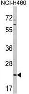 Cell Division Cycle 42 antibody, GTX81645, GeneTex, Western Blot image 