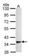 G Protein-Coupled Receptor 82 antibody, GTX100196, GeneTex, Western Blot image 