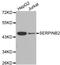 DLG Associated Protein 5 antibody, STJ25484, St John