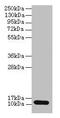 S100 Calcium Binding Protein A4 antibody, CSB-PA020632HA01HU, Cusabio, Western Blot image 