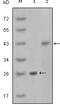 Alpha-Methylacyl-CoA Racemase antibody, 32-107, ProSci, Enzyme Linked Immunosorbent Assay image 