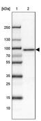 Tetratricopeptide repeat protein 7B antibody, PA5-63561, Invitrogen Antibodies, Western Blot image 
