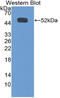 Interferon Gamma Receptor 1 antibody, LS-C297681, Lifespan Biosciences, Western Blot image 