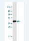 Oxysterol Binding Protein 2 antibody, H00023762-M10-100ug, Novus Biologicals, Western Blot image 