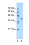 Transmembrane Protein 59 Like antibody, NBP1-69576, Novus Biologicals, Western Blot image 