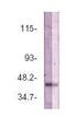 STEAP Family Member 1 antibody, PA1-29530, Invitrogen Antibodies, Western Blot image 