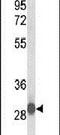 Katanin Regulatory Subunit B1 Like 1 antibody, PA5-26576, Invitrogen Antibodies, Western Blot image 