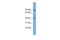 Dual Specificity Tyrosine Phosphorylation Regulated Kinase 1A antibody, GTX46524, GeneTex, Western Blot image 