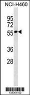 Zinc Finger Protein 302 antibody, 59-938, ProSci, Western Blot image 