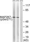 Mitogen-Activated Protein Kinase Kinase 7 antibody, PA5-37703, Invitrogen Antibodies, Western Blot image 