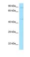 Protein Kinase C And Casein Kinase Substrate In Neurons 1 antibody, orb331580, Biorbyt, Western Blot image 