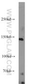 AF4/FMR2 Family Member 1 antibody, 19975-1-AP, Proteintech Group, Western Blot image 