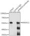 Annexin A11 antibody, A05379, Boster Biological Technology, Immunoprecipitation image 