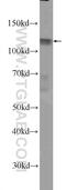 DIS3 Like Exosome 3'-5' Exoribonuclease antibody, 25746-1-AP, Proteintech Group, Western Blot image 