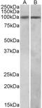BEN Domain Containing 5 antibody, 43-359, ProSci, Enzyme Linked Immunosorbent Assay image 