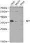SET Nuclear Proto-Oncogene antibody, 22-055, ProSci, Western Blot image 