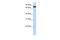 Zinc Finger Protein 33A antibody, PA5-43694, Invitrogen Antibodies, Western Blot image 